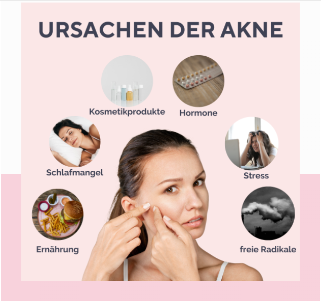 Acne Treatment Blog