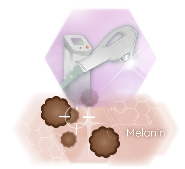 permanent hair removal laser hair removal permanent hair removal laser hair removal